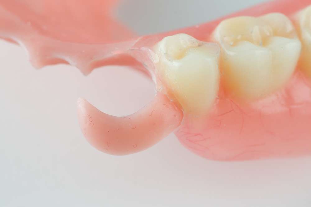 partial dentures before and after